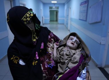 A woman holds her malnourished baby at the Ataturk Children's Hospital in Kabul, Afghanistan, Wednesday, May 18, 2022. (AP Photo/Ebrahim Noroozi)