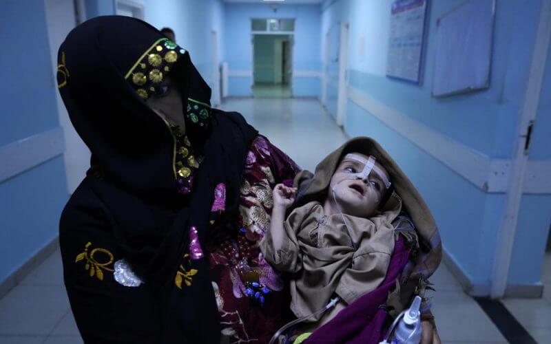 A woman holds her malnourished baby at the Ataturk Children's Hospital in Kabul, Afghanistan, Wednesday, May 18, 2022. (AP Photo/Ebrahim Noroozi)