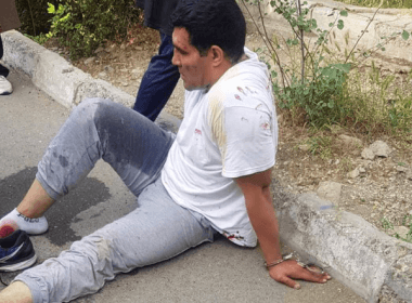 Iranian boxer Reza Moradkhani after he was shot by a hijab police. iranintl.com